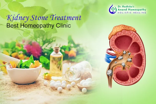 kidney stone treatment