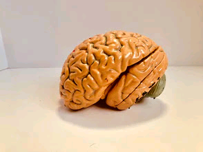 Brain tumour growth