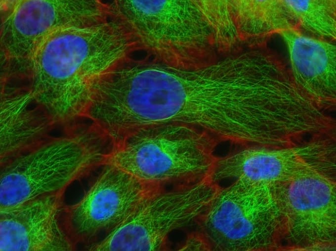 Breast Cancer Cells Converted Into Fat Cells To Prevent Metastases. 