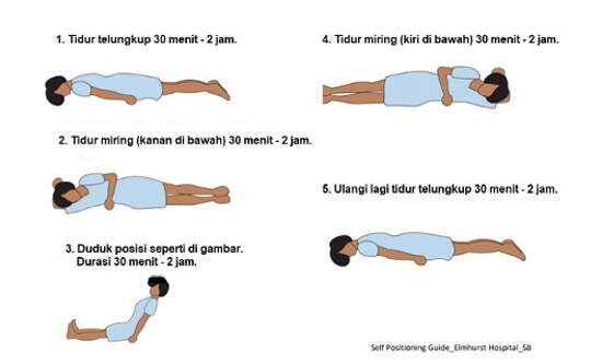 proning, oksigenasi, covid-19, tengkurap, posisi tidur