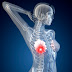 Signs And Symptoms Of Breast Cancer Complete