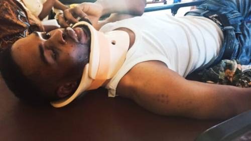 Immigration Officers Assault Passport Applicant In Ekiti, Break His Neck, Arm, Toes, Others