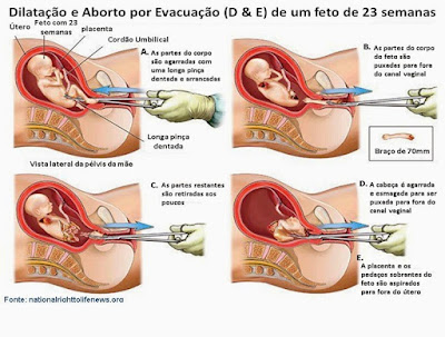 Aborto: Levando a vida seriamente