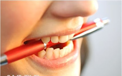 Răng sứ Zirconia có tốt hay không?