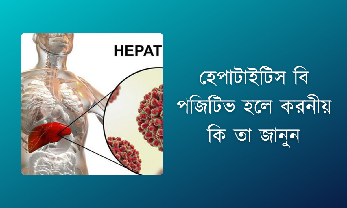 হেপাটাইটিস বি পজিটিভ হলে করনীয় কি তা জানুন