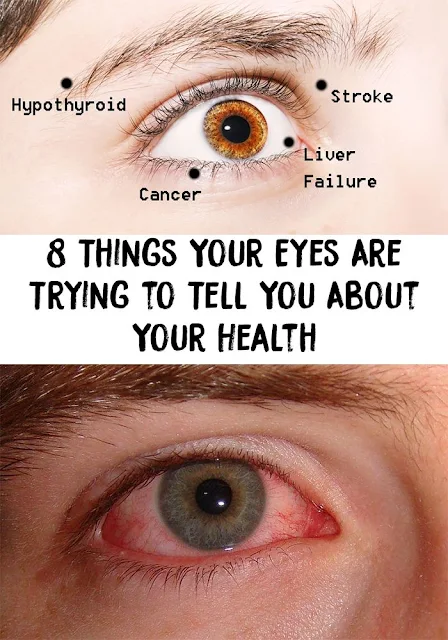 8 Things Your Eyes Are Trying to Tell You About Your Health