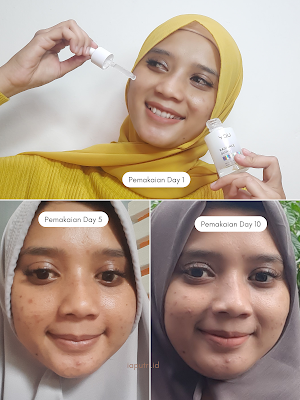 Progress Pemakaian You Radiance Glow Illuminating Serum