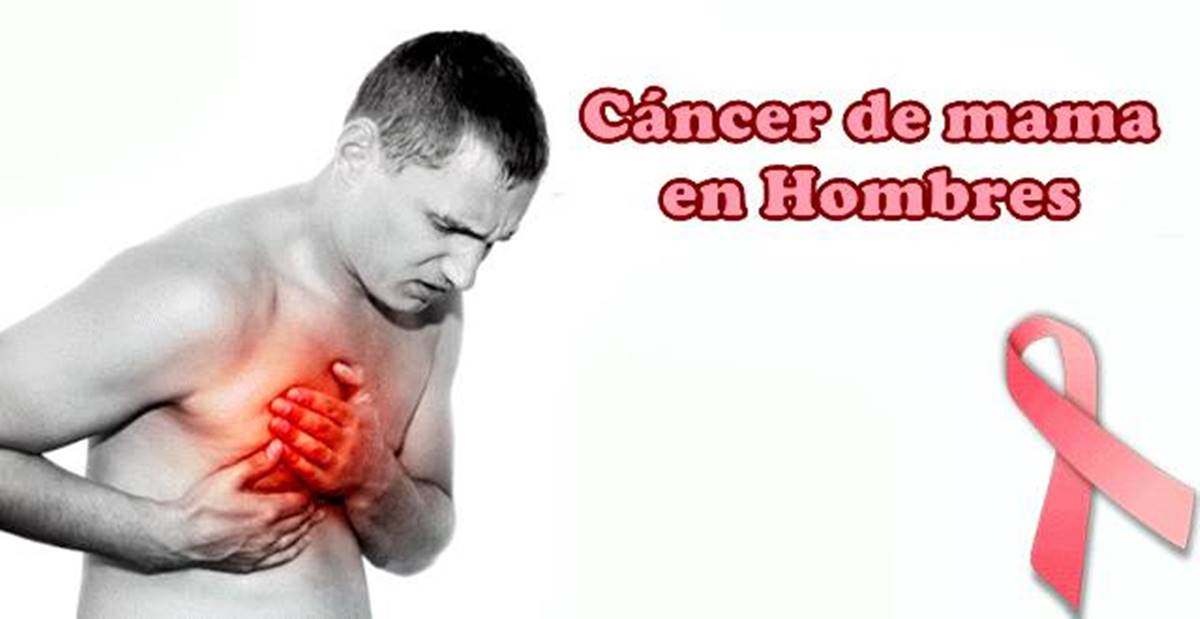 Cáncer de mama en los hombres