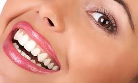 home-teeth-whitening