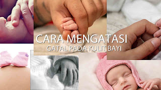 gatal pada kulit bayi