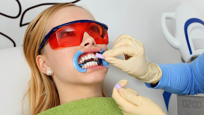 Tẩy trắng răng có hại cho răng không?