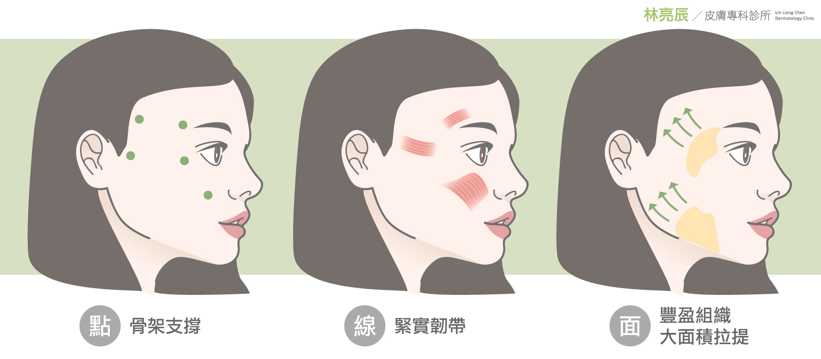 4D童妍針(Sculptra舒顏萃)可以透過不同的濃度注射層次達到不同的效果全方位改善老化問題