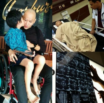 Foto Deddy Corbuzier lumpuh di Kursi Roda Akibat Diet OCD 