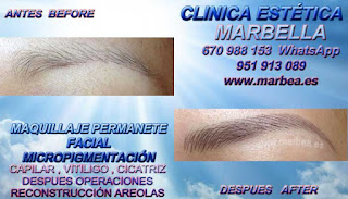 microblading M&#225;laga Clínica Estética Maquillaje Permanente Facial,  Micropigmentación Capilar y microblading cejas en M&#225;laga y Marbella: Te proponemos la mayor calidad de nuestroservicio con los mejores especialistas en micropigmentación capilar y microblading cejas