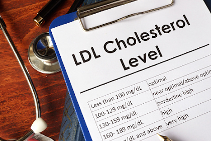 Gejala Kolesterol Tinggi dan Cara Mencegahnya