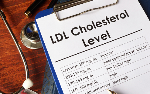 Gejala Kolesterol Tinggi dan Cara Mencegahnya