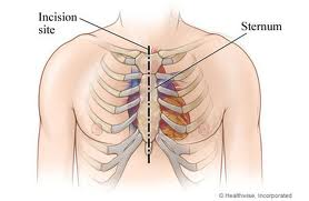 Physician Anesthesia will perform general anesthesia.