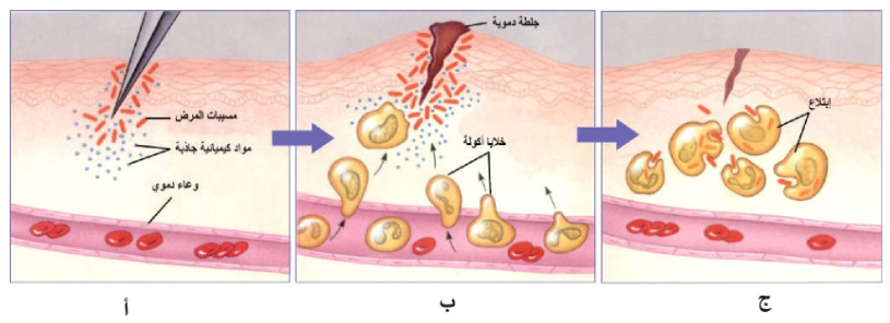 الشكل 21 - 11: مراحل تفاعل الالتهاب: أ) دخول جراثيم المرض عبر الجلد وافراز مواد جاذبة، ب) زيادة تدفق الدم وهجرة الخلايا الملتهمة نحو الإصابة وتكون الجلطة الدموية، ج) التهام وتراجع الجلطة.