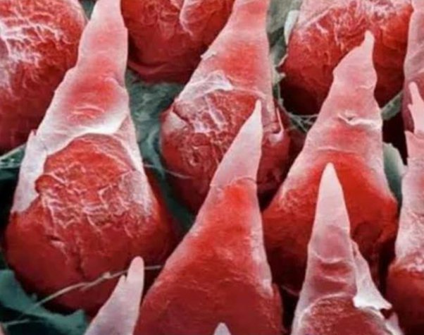 Human tongue under microscope