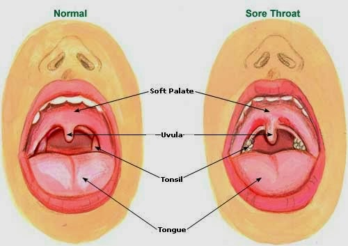 http://mengobatiradangtenggorokananak.blogspot.com/