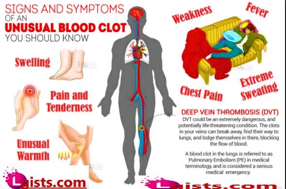 symptoms of blood clot in leg