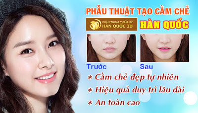 Phẫu thuật tạo cằm chẻ đẹp tự nhiên