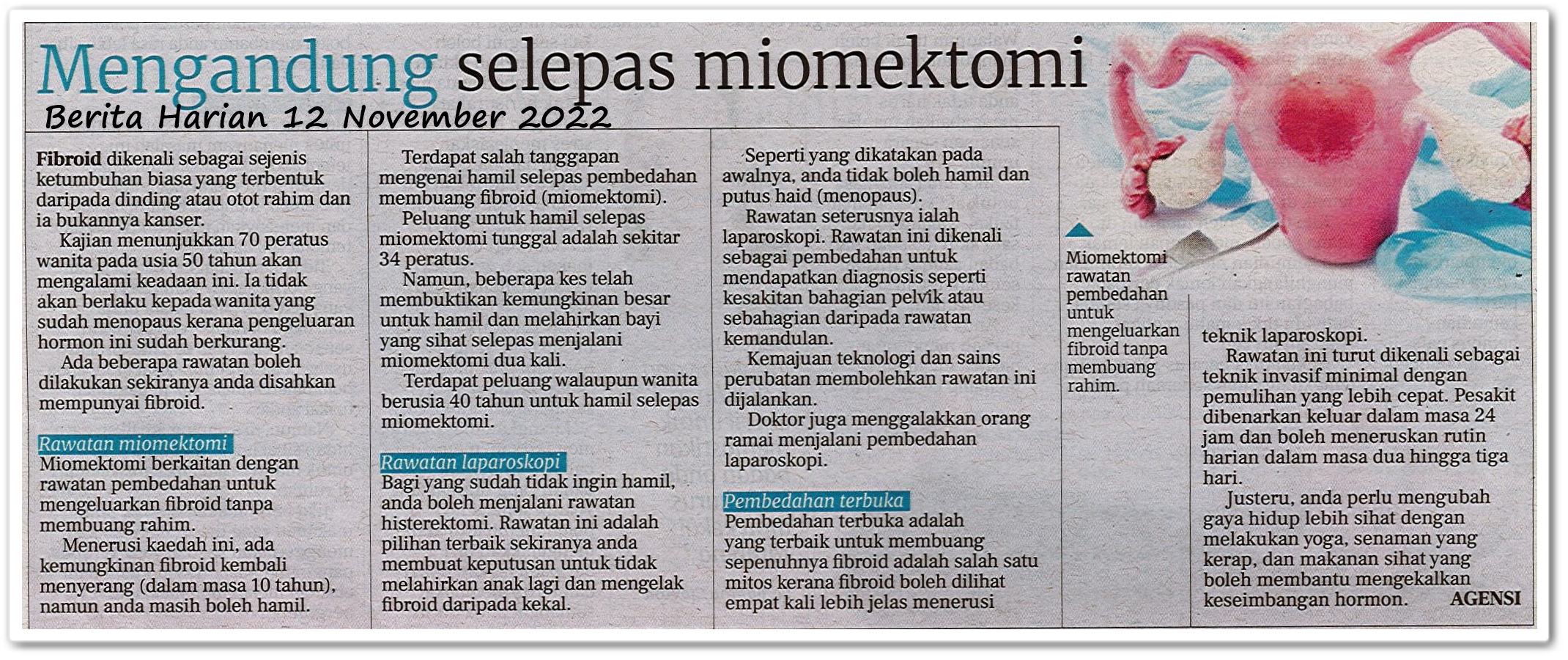 Mengandung selepas miomektomi - Keratan akhbar Berita Harian 12 November 2022