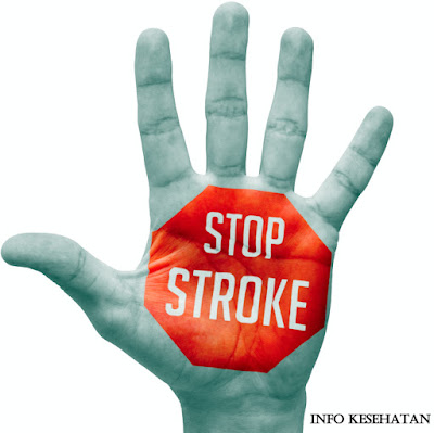 http://beranisehat45.blogspot.com/2016/04/tips-agar-terhindar-dari-penyakit-stroke.html