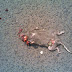 Hit n Run Victim Picture
