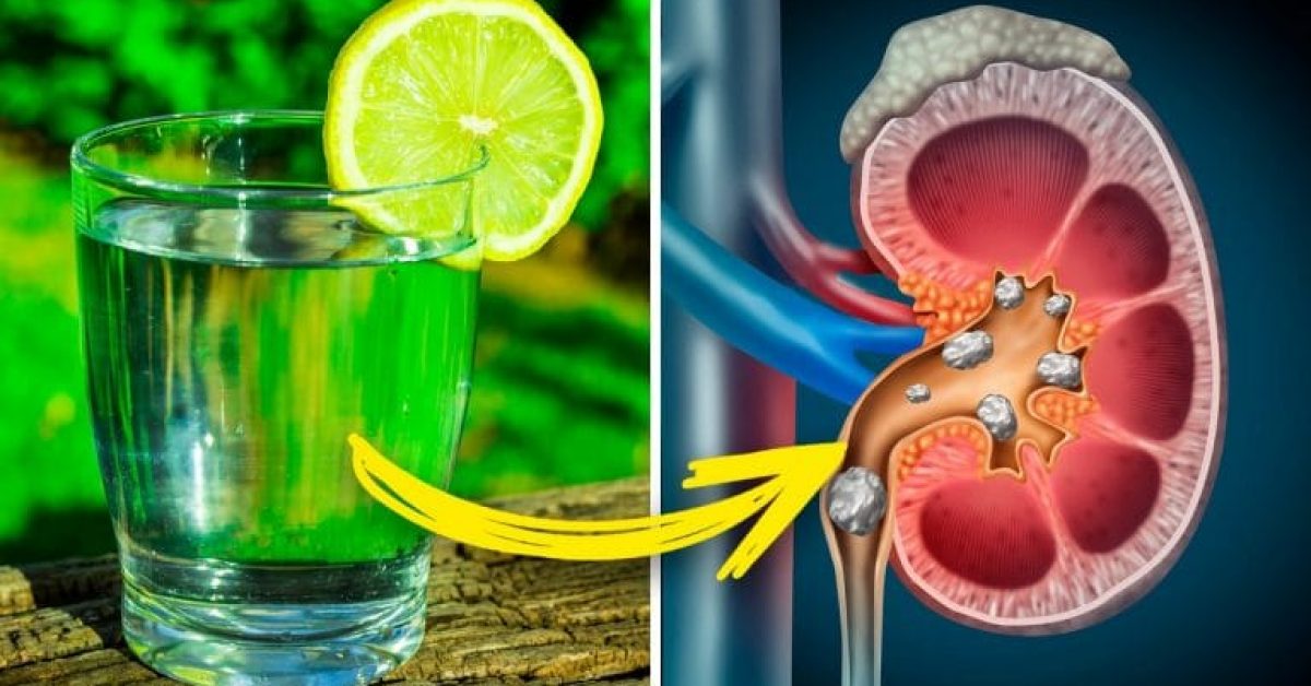 8 Diseases That Lemon Does To Your Body That You Should Know