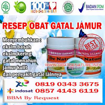 RESEP OBAT GATAL JAMUR