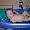 Circumcised Baby Bath - 1 - Certain doctors advise that while bathing the child, the parents need not clean the internal side of read more: