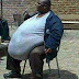 Obese man lost so
much weight that
he was detained by
police