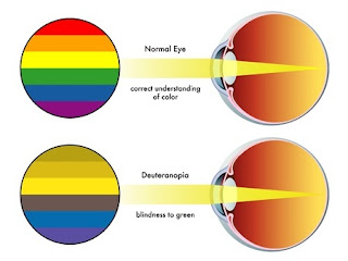 Gangguan pada mata ini tentunya sangat menganggu terutama bagi orang yang ingin memasuki institusi tertentu yang menerapkan tes buta warna sebagai persyaratan