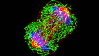 A dividing breast cancer cell.