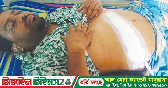 ভুল অস্ত্রোপচার! নারী রুগীর রিপোর্টে কাটা হলো পারভেজের পিত্তথলী!