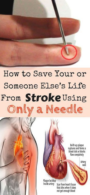 HERE’S HOW TO SAVE YOUR OR SOMEONE ELSE’S LIFE FROM STROKE USING ONLY A NEEDLE