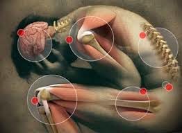 http://carapemesananacemaxs100.blogspot.com/2015/04/cara-cepat-mengobati-penyakit-rematik.html