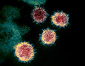 electron microscope image of SARS-CoV-2, the virus that causes COVID-19