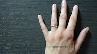 Mani Molto Secche Rimedi