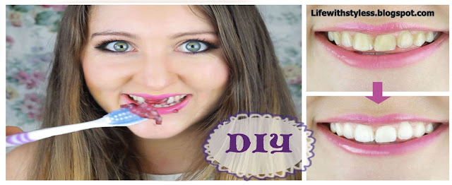 DIY 10 Home Remedies to Whiten Teeth