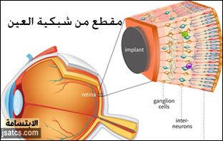 أفضل دكتور شبكية في الإمارات