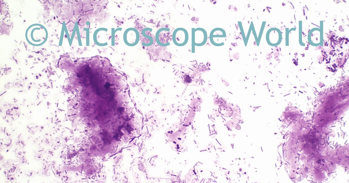 Microscope World Blog A Science Project Dirt Bacteria And Soap