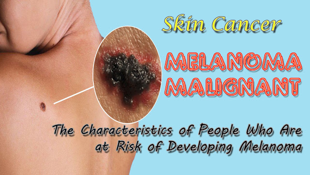 The Characteristics of People Who Are at Risk of Developing Melanoma