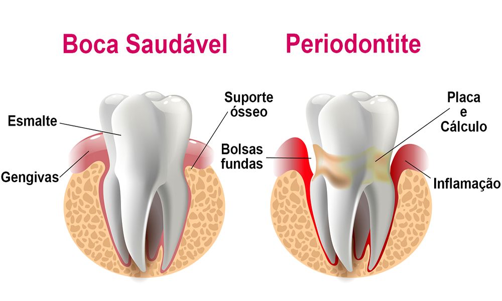 Periodontia