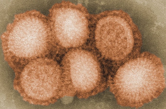 Gripe H1N2  em criança de Ohio