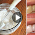 Guaranteed - How To Whiten Teeth Within 2 Minutes By Using 1 Ingredient