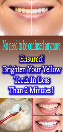 Ensured! Brighten Your Yellow Teeth In Less Than 2 Minutes! #LIFESTYLE