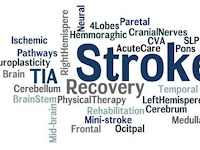 Pengobatan Stroke Memori