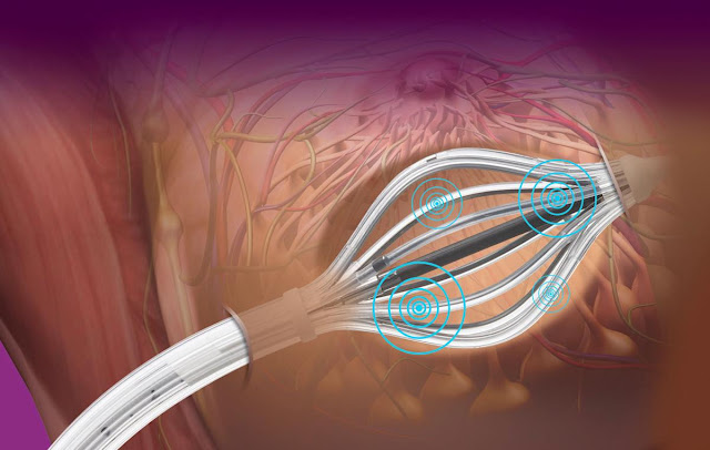 Brachytherapy Afterloaders Market